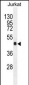OR4N4 Antibody (N-term)